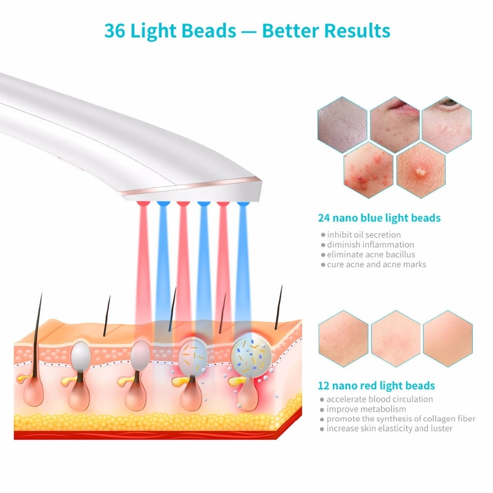 Acne Light Therapy Xpreen Wireless Rechargeable Light Acne Treatment Device Acne Clearing Eraser with Blue Light and Red Light CJdropshipping