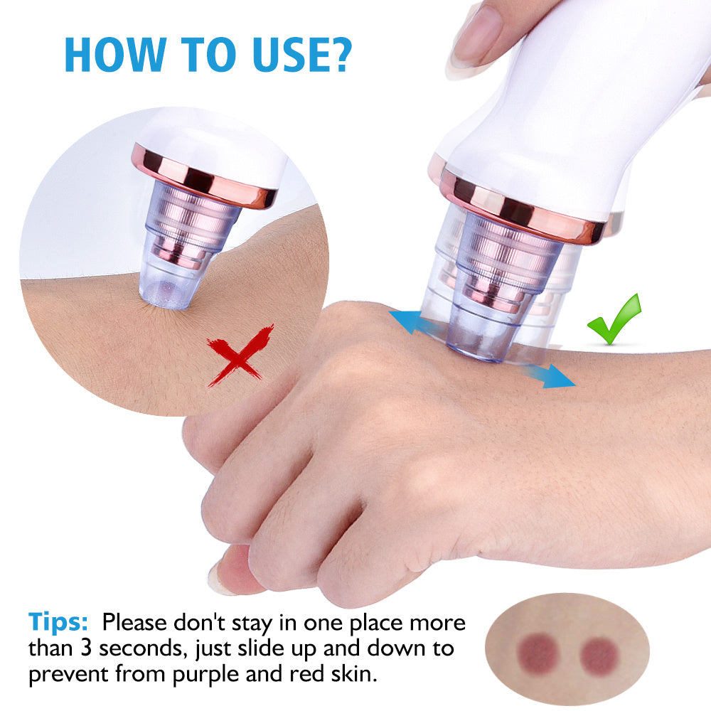 Blackhead Instrument Electric Suction Facial Washing Instrument Beauty Acne Cleaning Blackhead Suction Instrument CJdropshipping